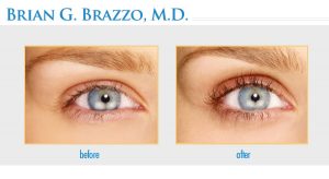 Eyelash Treatment New York City