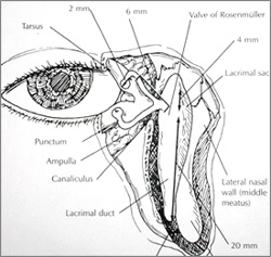 Tear Duct Blockage Treatment New York City